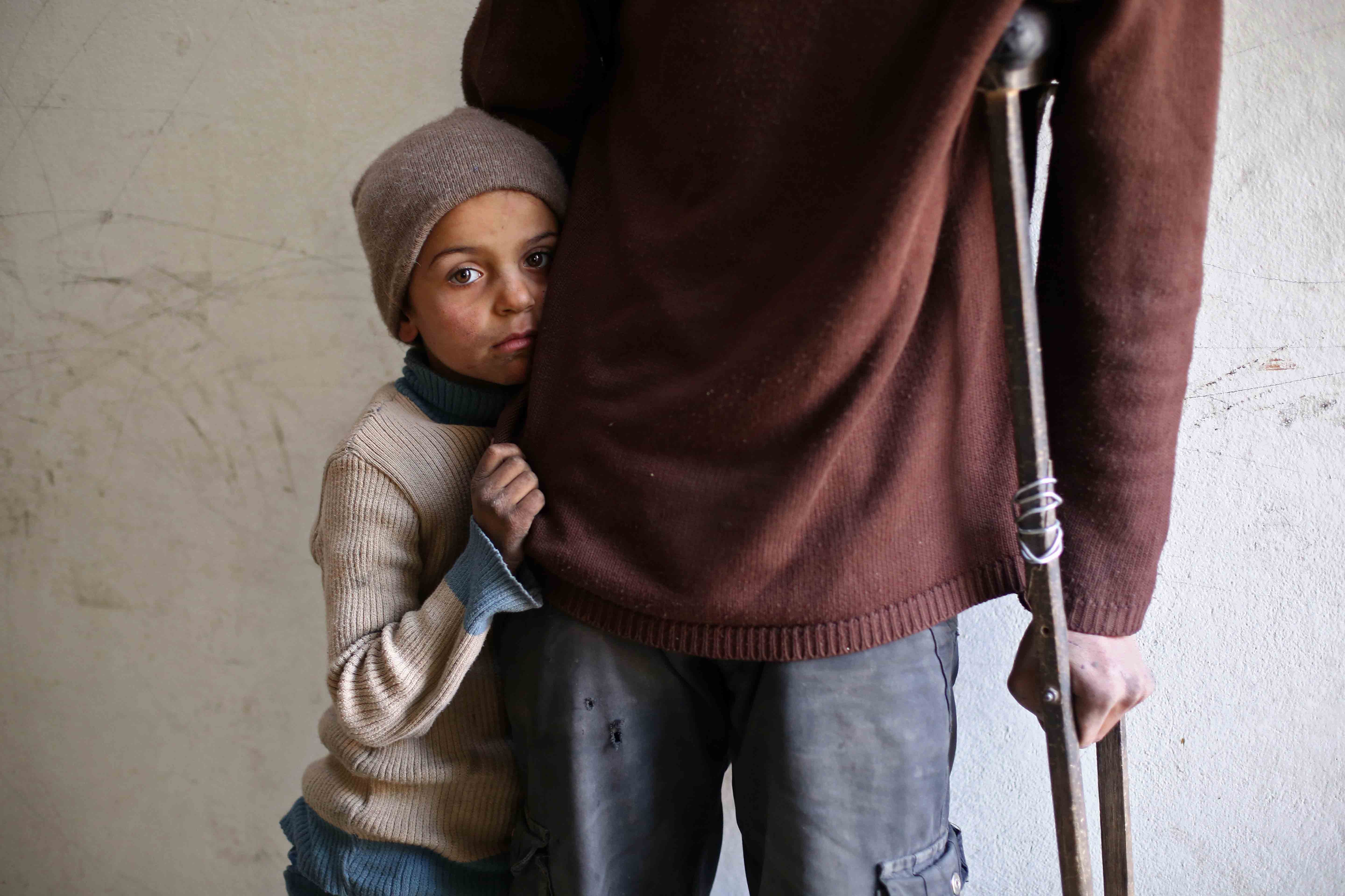 An impoverished Syrian girl hugs her injured father in the rebel-held town of al-Nashabiyah, east of Damascus, on November 30, 2017. The poignant image encapsulates the human cost of conflict and the repeating patterns of history.