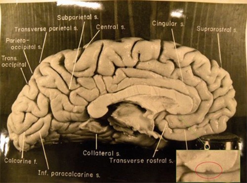 Exquisitely detailed hand-drawings by Ramón y Cajal illustrating neurons and synapses in the brain's grey matter, highlighting the intricate structure of the brain for learning.