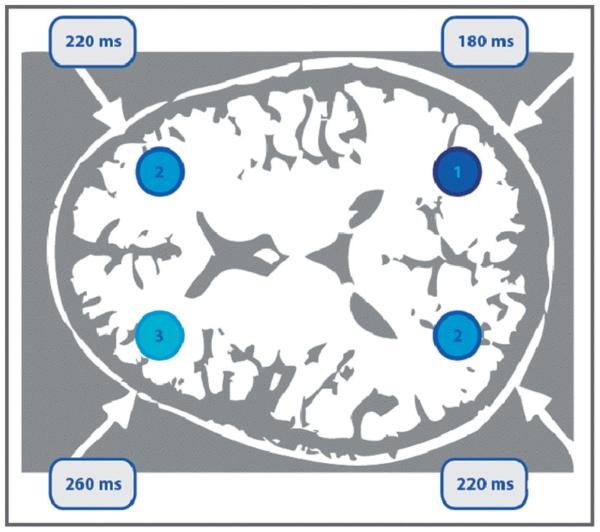 Accuracy in the 2-back task as a function of the time of transcranial magnetic stimulation (TMS).