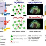 Model of SDL based on extrasynaptic GABAAR activation on hippocampal dentate gyrus interneurons.