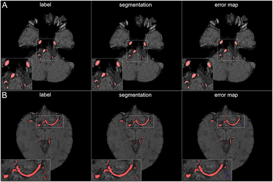 Segmentation Results for Large Vessels