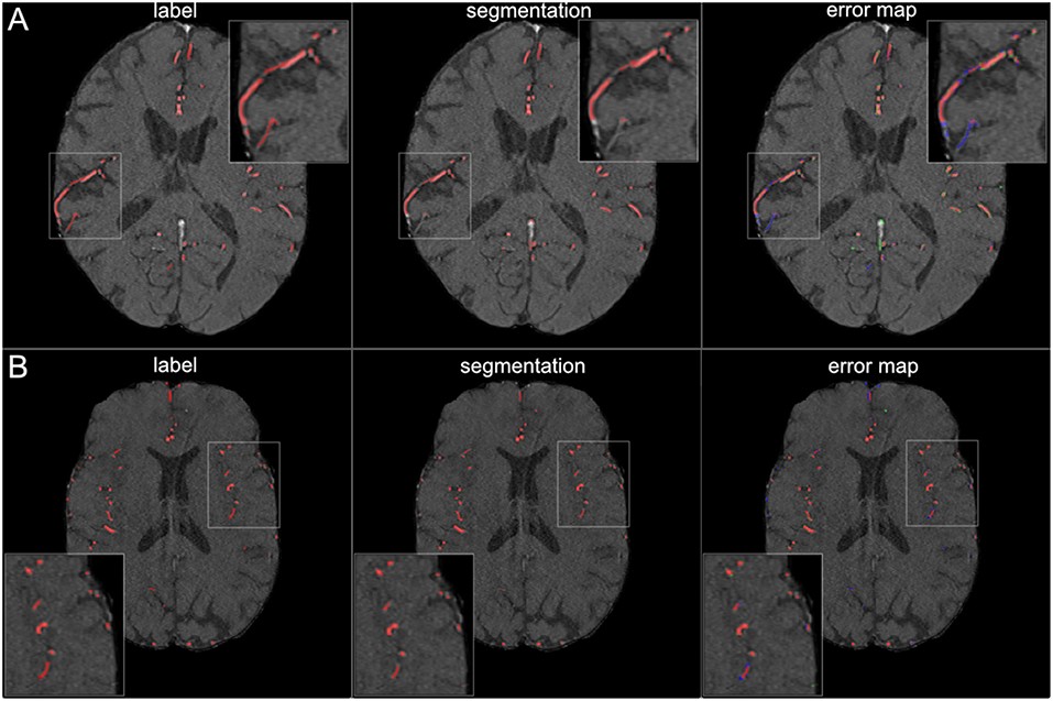 Segmentation Results for Small Vessels