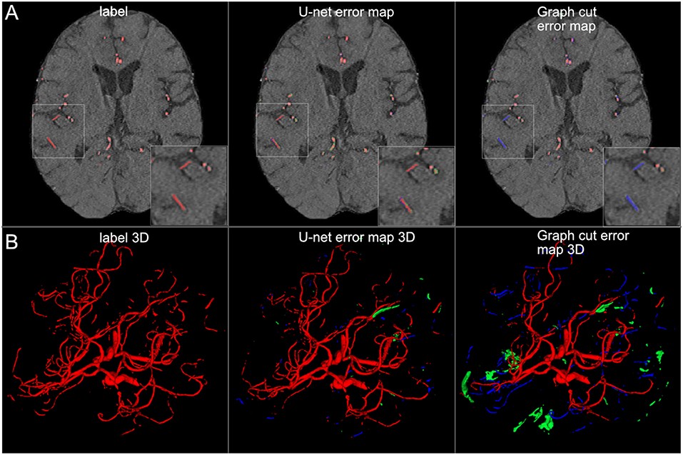 Comparison of U-net and Graph Cut Segmentations